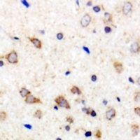 Immunohistochemical analysis of 42431 staining in human brain formalin fixed paraffin embedded tissue section. The section was pre-treated using heat mediated antigen retrieval with sodium citrate buffer (pH 6.0). The section was then incubated with the antibody at room temperature and detected using an HRP conjugacompact polymer system. DAB was used as the chromogen. The section was then counterstained with haematoxylin and mounted with DPX.