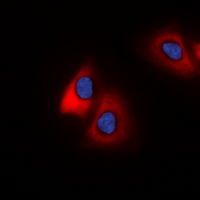 Immunofluorescent analysis of 42431 staining in HeLa cells. Formalin-fixed cells were permeabilized with 0.1% Triton X-100 in TBS for 5-10 minutes and blocked with 3% BSA-PBS for 30 minutes at room temperature. Cells were probed with the primary antibody in 3% BSA-PBS and incubated overnight at 4 deg C in a hidified chamber. Cells were washed with PBST and incubated with a DyLight 594-conjugated secondary antibody (red) in PBS at room temperature in the dark. DAPI was used to stain the cell nuclei (blue).