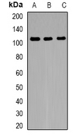 Western blot analysis of FNBP3 expression in HeLa (A); mouse brain (B); rat brain (C) whole cell lysates.