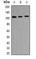 Western blot analysis of TRAK2 expression in HepG2 (A); mouse heart (B); rat heart (C) whole cell lysates.