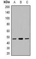 Western blot analysis of CACNG5 expression in HepG2 (A); mouse liver (B); RAW264.7 whole cell lysates.