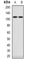 Western blot analysis of VPS54 expression in Jurkat (A); rat blood (B) whole cell lysates.