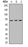 Western blot analysis of SETMAR expression in HEK293T (A); NIH3T3 (B); PC12 (C) whole cell lysates.