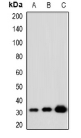 Western blot analysis of KLF13 (AcK166) expression in HeLa (A); NIH3T3 (B); PC12 (C) whole cell lysates.