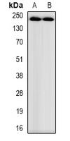 Western blot analysis of Myosin-pan (AcK505) expression in mouse heart (A); rat heart (B) whole cell lysates.