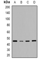 Western blot analysis of CD240d expression in HeLa (A); NIH3T3 (B); mouse brain (C); rat brain (D) whole cell lysates.