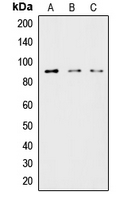 Western blot analysis of HSL expression in HeLa (A); MCF7 (B); COLO205 (C) whole cell lysates.