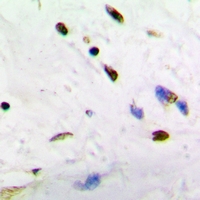 Immunohistochemical analysis of ADNP staining in human brain formalin fixed paraffin embedded tissue section. The section was pre-treated using heat mediated antigen retrieval with sodium citrate buffer (pH 6.0). The section was then incubated with the antibody at room temperature and detected using an HRP conjugacompact polymer system. DAB was used as the chromogen. The section was then counterstained with haematoxylin and mounted with DPX.