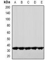 Western blot analysis of CNOT7 expression in HeLa (A); HuvEc (B); DKD (C); mouse brain (D); rat brain (E) whole cell lysates.