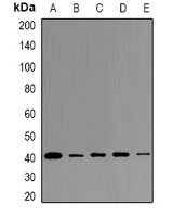 Western blot analysis of LPAAT gamma expression in K562 (A); A549 (B); PC12 (C); mouse testis (D); rat testis (E) whole cell lysates.