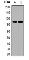 Western blot analysis of ADAM32 expression in HEK293T (A); human testis (B) whole cell lysates.