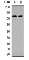 Western blot analysis of MLK4 expression in HT29 (A); Hela (B) whole cell lysates.