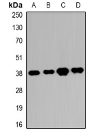 Western blot analysis of RRP7A/B expression in K562 (A); HEK293T (B); SHSY5Y (C); mouse eye (D) whole cell lysates.