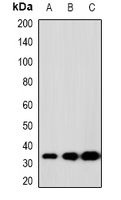 Western blot analysis of SCP3 expression in K562 (A); 22RV1 (B); H480 (C) whole cell lysates.
