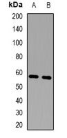 Western blot analysis of CD129 expression in KB (A); NIH3T3 (B) whole cell lysates.