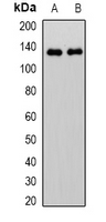 Western blot analysis of RFC1 expression in mouse liver (A); mouse kidney (B) whole cell lysates.