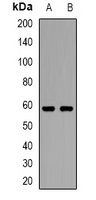 Western blot analysis of ASIC1 expression in mouse brain (A); mouse spinal cord (B) whole cell lysates.