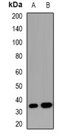 Western blot analysis of SOCS2 expression in HEK293T (A); Hela (B) whole cell lysates.