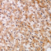 Immunohistochemical analysis of SOCS2 staining in human liver formalin fixed paraffin embedded tissue section. The section was pre-treated using heat mediated antigen retrieval with sodium citrate buffer (pH 6.0). The section was then incubated with the antibody at room temperature and detected using an HRP conjugacompact polymer system. DAB was used as the chromogen. The section was then counterstained with haematoxylin and mounted with DPX.