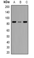 Western blot analysis of CD168 expression in HEK293T (A); MCF7 (B); MDAMB435 (C) whole cell lysates.