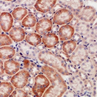 Immunohistochemical analysis of CD168 staining in human kidney formalin fixed paraffin embedded tissue section. The section was pre-treated using heat mediated antigen retrieval with sodium citrate buffer (pH 6.0). The section was then incubated with the antibody at room temperature and detected using an HRP conjugacompact polymer system. DAB was used as the chromogen. The section was then counterstained with haematoxylin and mounted with DPX.