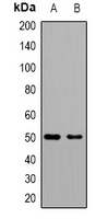 Western blot analysis of GAT1 expression in Hela (A); mouse brain (B) whole cell lysates.
