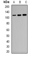 Western blot analysis of CD21 expression in Raji (A); KB (B); NIH3T3 (C) whole cell lysates.