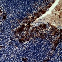Immunohistochemical analysis of CD21 staining in human tonsil formalin fixed paraffin embedded tissue section. The section was pre-treated using heat mediated antigen retrieval with sodium citrate buffer (pH 6.0). The section was then incubated with the antibody at room temperature and detected using an HRP conjugacompact polymer system. DAB was used as the chromogen. The section was then counterstained with haematoxylin and mounted with DPX.