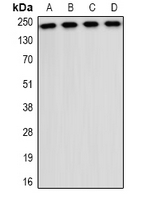 Western blot analysis of CD35 expression in A549 (A); NIH3T3 (B); mouse liver (C); mouse brain (D) whole cell lysates.