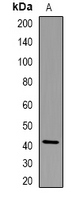 Western blot analysis of CD185 expression in NIH3T3 (A) whole cell lysates.