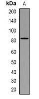 Western blot analysis of CD238 expression in mouse heart (A) whole cell lysates.