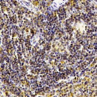 Immunohistochemical analysis of CD238 staining in human spleen formalin fixed paraffin embedded tissue section. The section was pre-treated using heat mediated antigen retrieval with sodium citrate buffer (pH 6.0). The section was then incubated with the antibody at room temperature and detected using an HRP conjugacompact polymer system. DAB was used as the chromogen. The section was then counterstained with haematoxylin and mounted with DPX.