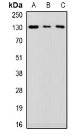Western blot analysis of MIB1 expression in HEK293T (A); K562 (B); Hela (C) whole cell lysates.