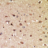 Immunohistochemical analysis of MIB1 staining in human brain formalin fixed paraffin embedded tissue section. The section was pre-treated using heat mediated antigen retrieval with sodium citrate buffer (pH 6.0). The section was then incubated with the antibody at room temperature and detected using an HRP conjugacompact polymer system. DAB was used as the chromogen. The section was then counterstained with haematoxylin and mounted with DPX.