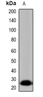 Western blot analysis of Tryptase delta expression in HepG2 (A) whole cell lysates.