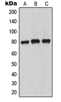 Western blot analysis of MARCKS (pS163) expression in MCF7 PMA-treated (A); SP2/0 PMA-treated (B); PC12 PMA-treated (C) whole cell lysates.