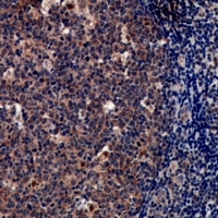 Immunohistochemical analysis of Tryptase delta staining in human tonsil formalin fixed paraffin embedded tissue section. The section was pre-treated using heat mediated antigen retrieval with sodium citrate buffer (pH 6.0). The section was then incubated with the antibody at room temperature and detected using an HRP conjugacompact polymer system. DAB was used as the chromogen. The section was then counterstained with haematoxylin and mounted with DPX.