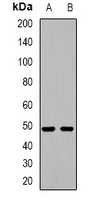 Western blot analysis of HIC5 expression in HepG2 (A); Hela (B) whole cell lysates.