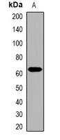 Western blot analysis of Collagen 25 alpha 1 expression in HepG2 (A) whole cell lysates.