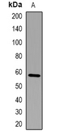 Western blot analysis of FBXO7 expression in mouse kidney (A) whole cell lysates.