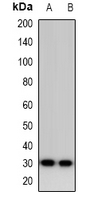 Western blot analysis of Calsarcin 1 expression in HepG2 (A); MDAMB453 (B) whole cell lysates.