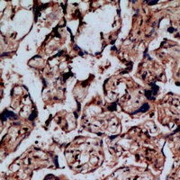 Immunohistochemical analysis of NOP56 staining in human placenta formalin fixed paraffin embedded tissue section. The section was pre-treated using heat mediated antigen retrieval with sodium citrate buffer (pH 6.0). The section was then incubated with the antibody at room temperature and detected using an HRP conjugacompact polymer system. DAB was used as the chromogen. The section was then counterstained with haematoxylin and mounted with DPX.