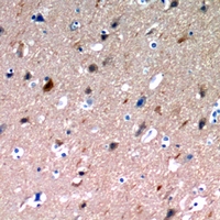 Immunohistochemical analysis of NLRX1 staining in human brain formalin fixed paraffin embedded tissue section. The section was pre-treated using heat mediated antigen retrieval with sodium citrate buffer (pH 6.0). The section was then incubated with the antibody at room temperature and detected using an HRP conjugacompact polymer system. DAB was used as the chromogen. The section was then counterstained with haematoxylin and mounted with DPX.