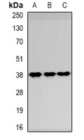 Western blot analysis of SPFH1 expression in HepG2 (A); NIH3T3 (B); Hela (C) whole cell lysates.