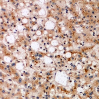 Immunohistochemical analysis of SPFH1 staining in human liver formalin fixed paraffin embedded tissue section. The section was pre-treated using heat mediated antigen retrieval with sodium citrate buffer (pH 6.0). The section was then incubated with the antibody at room temperature and detected using an HRP conjugacompact polymer system. DAB was used as the chromogen. The section was then counterstained with haematoxylin and mounted with DPX.
