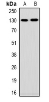 Western blot analysis of Collagen 1 alpha 1/2 expression in HEK293T (A); Hela (B) whole cell lysates.