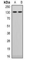 Western blot analysis of NFAT5 expression in Hela (A); HEK293T (B) whole cell lysates.