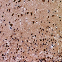 Immunohistochemical analysis of NFAT5 staining in human brain formalin fixed paraffin embedded tissue section. The section was pre-treated using heat mediated antigen retrieval with sodium citrate buffer (pH 6.0). The section was then incubated with the antibody at room temperature and detected using an HRP conjugacompact polymer system. DAB was used as the chromogen. The section was then counterstained with haematoxylin and mounted with DPX.