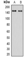 Western blot analysis of IRS2 expression in HepG2 (A); Hela (B) whole cell lysates.