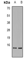 Western blot analysis of RPA3 expression in SW480 (A); MCF7 (B) whole cell lysates.